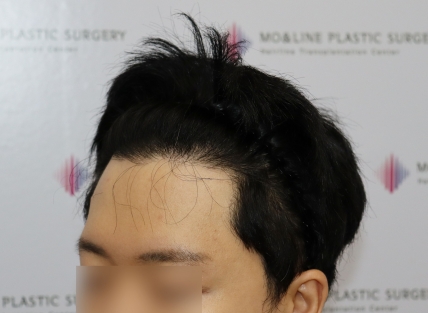 치료후기 이미지